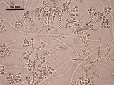 6 - Fascicoli corticali
